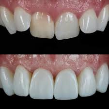 Dr. Gabor Tamas Pinter Md Dmd