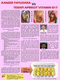 Ada berbagai upaya yang perlu anda jalani agar terhindar dari penyakit mematikan satu ini. Kanser Payudara Vs Terapi Vitamin B17