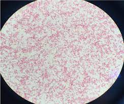 Legionella species growing on agar plate illuminated using ultraviolet light to increase contrast. Fatal Legionella Pneumophila Serogroup 1 Pleural Empyema A Case Report