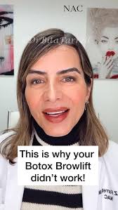 Needle vs knife for a brow lift., There are limitations to what a brow lift  with Botox or any neuromodulator can achieve. A toxin-based lift works by  relaxing the depressor muscles so the frontalis, ...