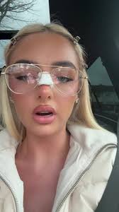 Robyn McDonnell nose job incident