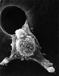 Image result for Pseudopod Ospermum