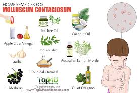 Home Remedies For Molluscum Contagiosum Top 10 Home Remedies Top 10 Home Remedies Home Remedies For Acne Home Remedies