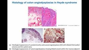 Abraham Dévora Martínez