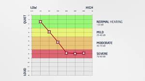 Check spelling or type a new query. What Is An Audiogram And How To Read It Hear Com