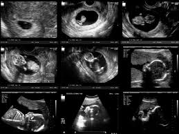 Pin On Pregnancy Months