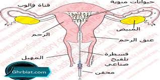 دعونا ننظر في مزيد من التفاصيل العوامل التي تحدد نتيجة إيجابية التلقيح الصناعي للمرة الأولى. Ù†Ø¯Ø§Ø¡ Ù„ØªÙƒÙˆÙ† Ø¬Ø°Ø§Ø¨Ø© Ø¬Ø§Ø¦Ø²Ø© Ø§Ùˆ Ù…ÙƒØ§ÙØ§Ø© ØªØ­Ø¯ Ø§Ù„ØªÙ„Ù‚ÙŠØ­ Ø§Ù„ØµÙ†Ø§Ø¹ÙŠ Ø§Ù„Ù…Ù†Ø²Ù„ÙŠ ØªØ¬Ø§Ø±Ø¨ÙƒÙ… Newhongfa Com