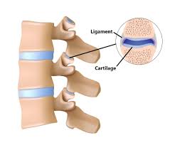 Treatment usually involves closed or open reduction followed by surgical stabilization. Facet Joint Injuries My Family Physio