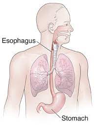 Check spelling or type a new query. Esophageal Spasm