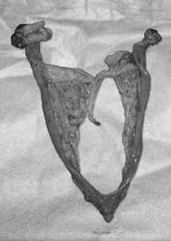 Un Caso De Hermafroditismo Verdadero 78 Xx En Una Perra Weimaraner E sempre foram e são essenciais para a medicina. hermafroditismo verdadero 78 xx