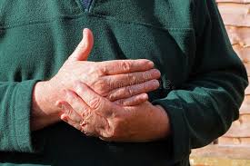 Viejo Sirve La Mano Derecha Dolor Artritis Imagen De Archivo Imagen De Hombre Sirve 112283897