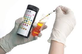 ارتفاع حمض اليوريك Uric Acid The Arab Hospital Magazine