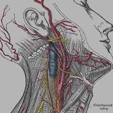 Cervical Artery Dissection Rcemlearning