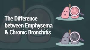 Symptoms rarely begin before middle age. Lung Health Institute Difference Between Emphysema Chronic Bronchitis