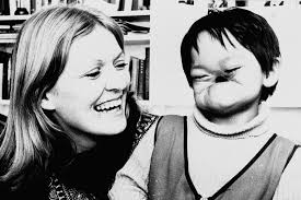 How the boy with no face learnt to smile