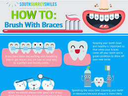 We don't want you to experience any of these unpleasant problems, so we've put together expert advice on how to keep your mouth healthy for the duration of your brace journey. How To Brush With Braces