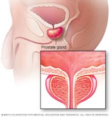 psa test mayo clinic