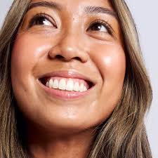 Erlyn the eczema warrior.