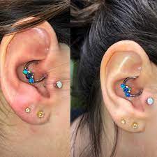 Do You Guys Notice A Difference In The Hypertrophic Scarring From The First To The Second Pic Been Doing Sea Salt Soaks Twice A Day And Rinsing In The Shower Any Other