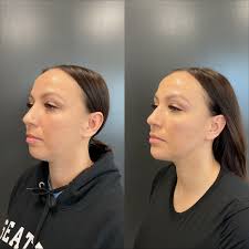 Meet Our Team! Kortney Jones, ARNP Kortney specializes in women's health,  hormone replacement, medical weight loss, vaginal rejuvenation, and medical  aesthetics including filler & Botox. Medical Director and Nurse  Practitioner, Kortney Jones