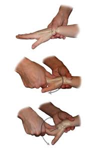 Image result for Scaphoid Shift Test