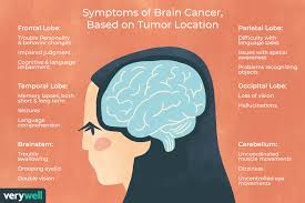 Brain cancer is one of the most dangerous health disease in present days. Brain Cancer Overview And More
