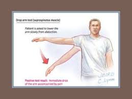 Image result for Drop Arm Test