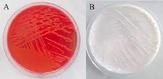There are two species of salmonella: Diagnostic Challenge Of Gastrointestinal Infection Due To Lactose Fermenting Salmonella Enterica Subsp Enterica Serovar 4 5 I Sciencedirect