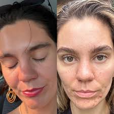 Introducing our incredible esthetician, Sarah Abney. Sarah is a natural  born healer and a rare breed of empaths. She cares deeply about the  integrity of her work and is incredibly impactful with