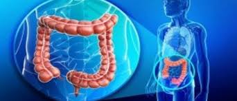 Some of the most common symptoms of advanced colon cancer include bloody stools, differences in usual bowel habits and chronic abdominal discomfort. Advanced Colon Cancer Patients Undergoing Less Surgery And Demonstrating Better Survival Oncology Central