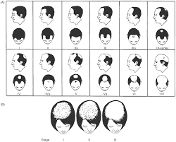 In guys, androgens work to develop male doing nothing: Androgens And Hair A Biological Paradox With Clinical Consequences Chapter 7 Testosterone