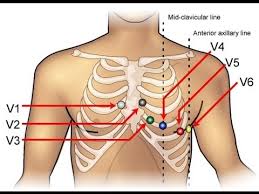 Ecg Electrode Electrocardiogram Electrode Latest Price