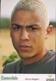 ▷ Emmerdale's Danny Daggert