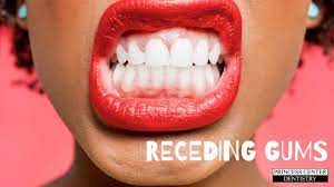 Why do you have receding gum? How Dentists Treat Receding Gums Princess Center Dentistry Scottsdale Az