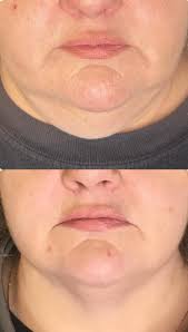 About Face Wellness and Medical Spa