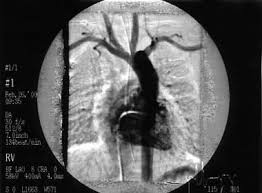 Fetal Echocardiography To Plan Postnatal Management In Fetuses With  Congenital Heart Disease | Springerlink