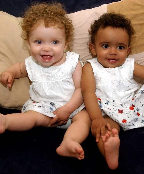 Mga resulta ng larawan para sa Black and White Twins"