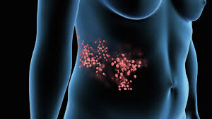 Translation of shingles in spanish. Shingles Youtube