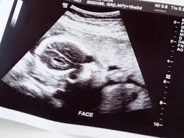 Free pregnancy test clinics and centers around the country. My Slightly Unreal Pandemic Pregnancy The New Yorker