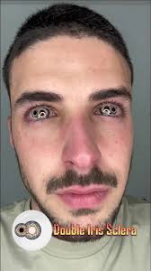 Double Iris Sclera Contact Lenses Exploration