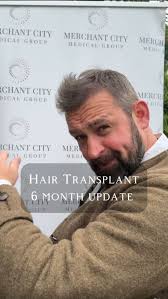 Here is a wee update 6 months after my hair transplant!, I wanted to share  my hair journey with you all and to be totally honest about the good and  the bad. The initial procedure was more painful than ...