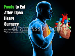 diet after open heart surgery foods to eat foods to avoid