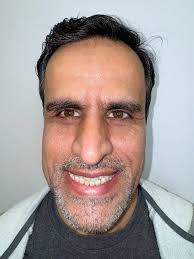 In Conclusion…A guest post by Lysle Johnstone This is a guest blog post by  Lysle Johnston one of World's most respected orthodontists. He addresses  some of the issues