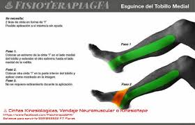 Https Www Facebook Com Fisioterapiagfa Estamos Para Servirte 5591053322 F T Flores Cintas Rodillas Esguince