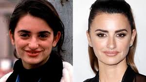 Hola jesus, que tal estas despues de unos meses pasados de la operacion, queria preguntarte por que estoy pensando en hacer el mismo tratamiento. El Cambio Radical De Penelope Cruz Se Ha Realizado Retoques