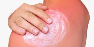 How To Stop Sunburn Itch 7 Ways To Soothe Your Skin