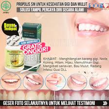 Ada banyak obat pereda rasa sakit yang beredar di pasaran, anda dapat menggunakan beberapa obat yang disarankan seperti. Obat Untuk Gigi Ngilu Obat Gigi Goyang Gigi Sakit Dan Nyeri Gigi Linu Gigi Abses Gigi Keropos Gigi Berlubang Gigi Bengkak Gigi Berdarah Gigi Bau Busuk Gigi Cenat Cenut Sakit Gigi Infeksi