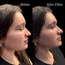 Caitlin Powers MSN, APRN, FNP-C (@injectorcaitlinnp) · Johnson City, TN