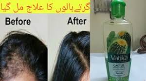 Get the best deal for vatika hair serums & oils from the largest online selection at ebay.com. Vatika Cactus Hair Oil Review Hair Fall Control Oil Tee Fatima Youtube