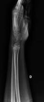 Image result for Normal Anatomic Position of the Hand and Wrist